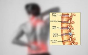 Read more about the article המלצת מטופל שסבל מדלקת כתף ודלקת בעצבים ברגל